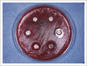 抗生物質の感受性テスト