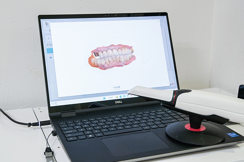 TRIOS 4 オーラルスキャナシステム （口腔内スキャナー）